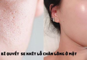 Bí quyết se khít lỗ chân lông ở mặt và giữ da sáng mịn khỏe mạnh