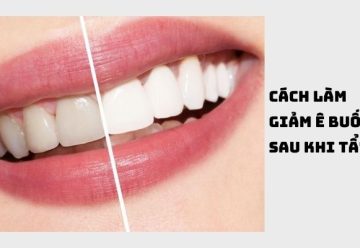 Hướng dẫn cách làm giảm ê buốt răng sau khi tẩy trắng hiệu quả